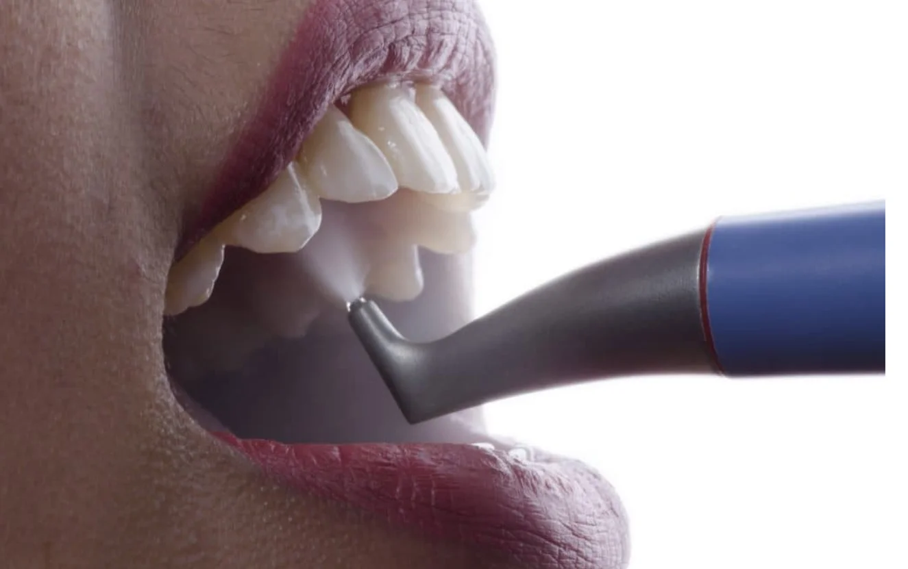 Dental Hygienist East Dulwich General Dentistry New Private Patients Consultations Announced at The Gardens Dental Centre (Smile 4 U)